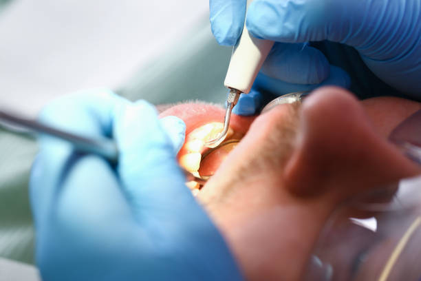 Best Pediatric Emergency Dentist in Greenfield, TN